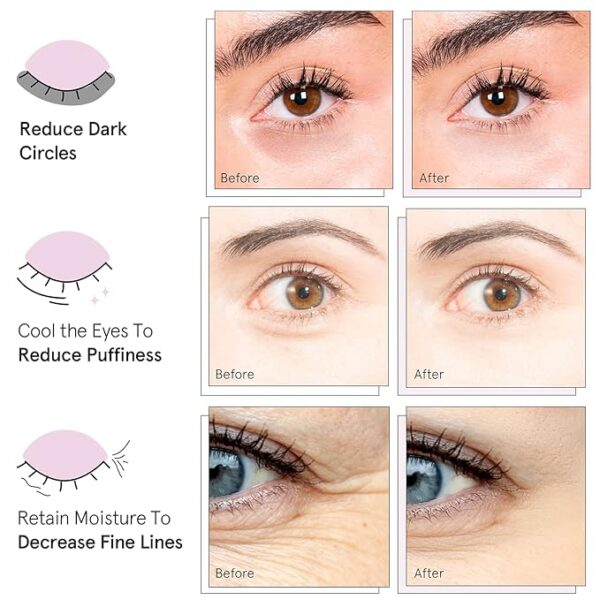 Limited Time deal 22% OFF Circles, Puffy Eyes, Undereye Bags, - Image 3