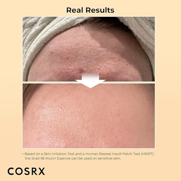 Limited Time deal 25% OFF  Snail Secretion Filtrate for Dull Skin & Fine Lines, Korean Skin Care - Image 3